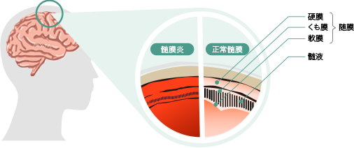 髄膜と髄液